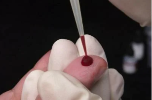 Test de sânge pentru helminți