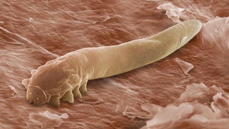 vierme care trăiește sub pielea umană