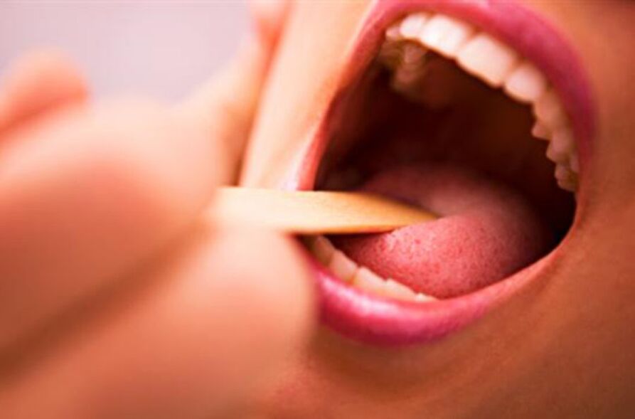 tipuri de paraziți în gura umană